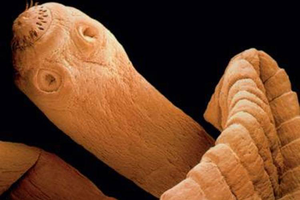 Paciente muere con tumores cancerosos originados por la solitaria