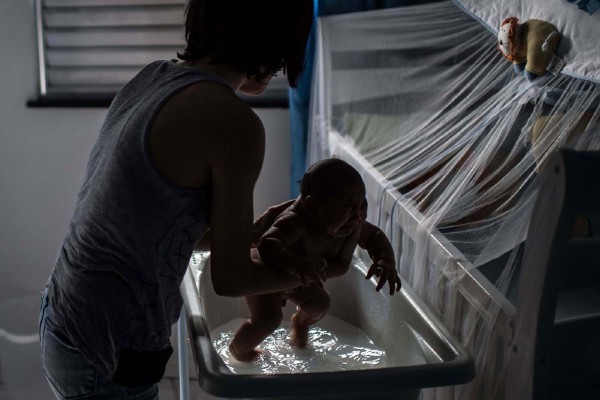Primer caso de bebé con microcefalia debido al zika en Nueva York