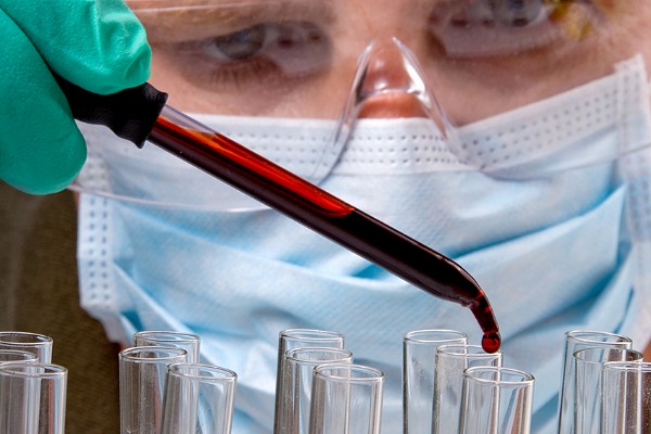 Una gota de sangre y nueve minutos para detectar zika