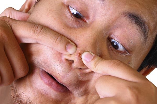 Exprimir un grano podría causar la muerte