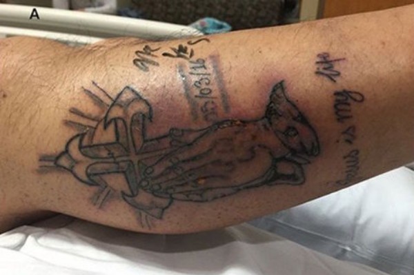Recién tatuado muere tras infección por nadar en el Golfo de México