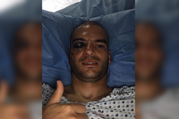 Portero de Lobos BUAP a punto de perder un ojo