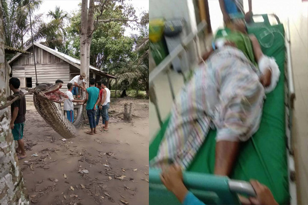 Hombre pierde el brazo al luchar contra una gigantesca pitón