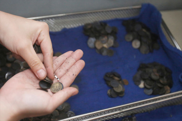 Cirujanos hallan monedas, cuchillas y agujas en estómago de un hombre