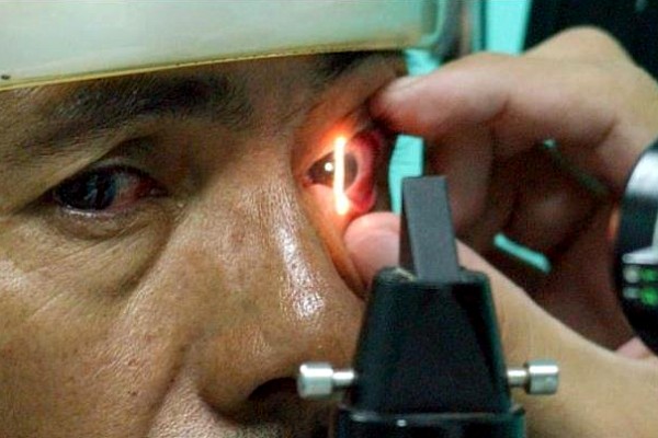 Glaucoma puede provocar pérdida total y permanente de la vista