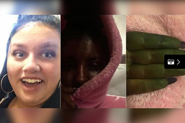 Intentaba lucir piel bronceada, pero terminó verde como Fiona