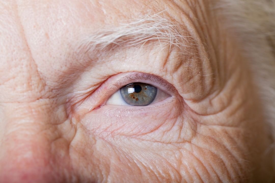 80 % de casos de visión deficiente se considera evitable: oftalmólogo