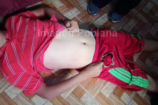 Fallece adolescente por una extraña intoxicación
