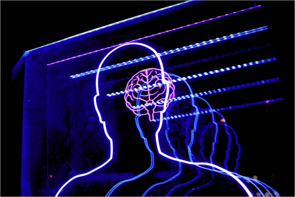 Esto le pasa a tu cerebro cuando le falta una mitad