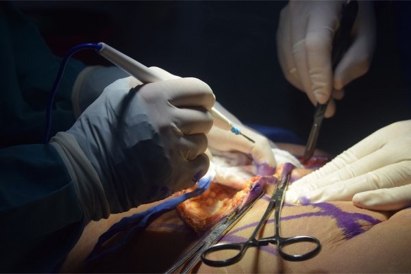 Se incrementan quejas contra médicos esteticistas