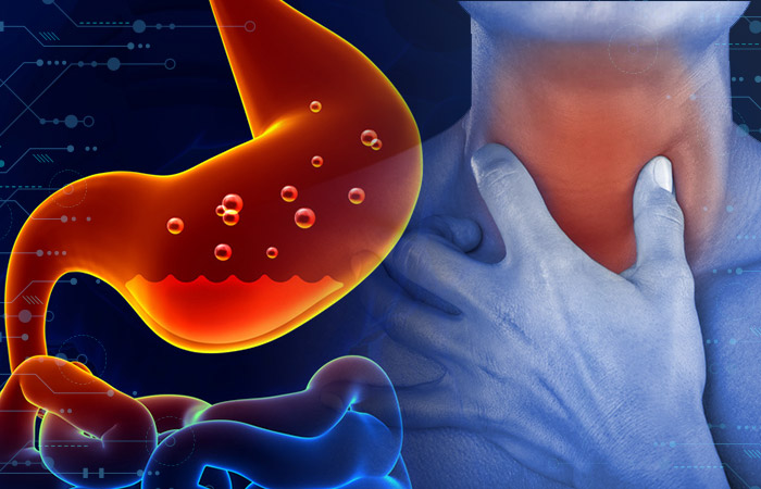 Reflujo y cáncer de estómago, flagelos de mexicanos