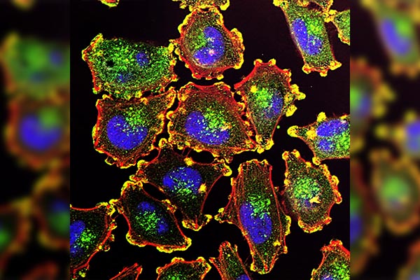 ¿El principio del fin del cáncer? Investigadores hacen prometedor descubrimiento
