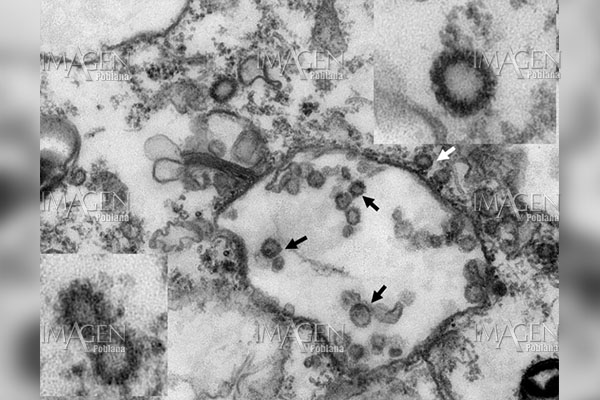 Identifican al pangolín como potencial hospedador intermedio del coronavirus