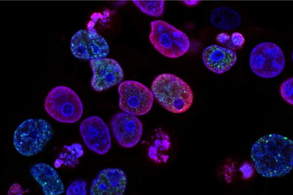 El método más eficaz para evitar el desarrollo del cáncer