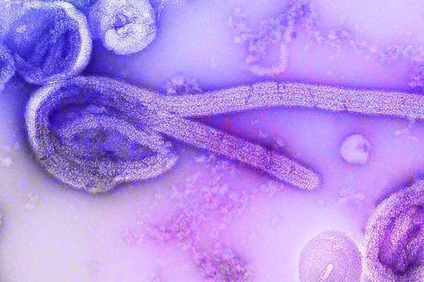Detectan en Brasil un misterioso virus de genes desconocidos