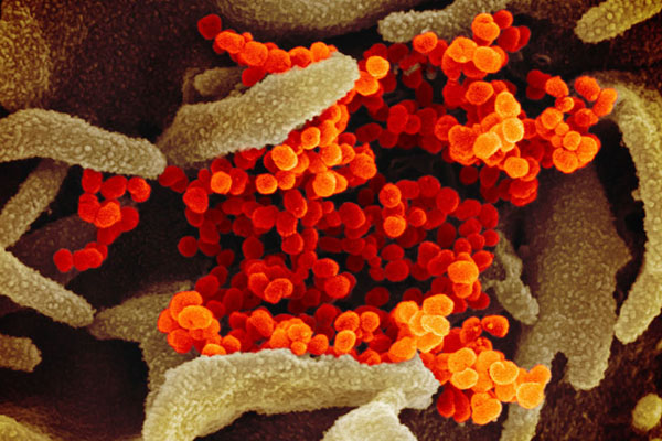 Publican fotos del coronavirus chino a color y en alta resolución