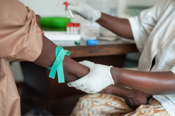 Mueren 103 personas por brote de fiebre de Lassa