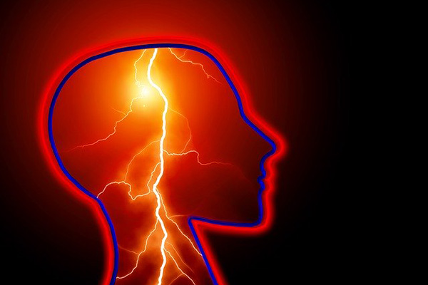 Epilepsia afecta a más de 50 millones de personas en todo el mundo