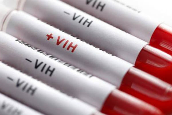 Médicos confirman segunda curación del VIH en la historia