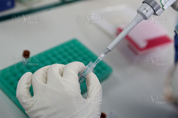 Bosch elabora un test que diagnostica el coronavirus en 2.5 horas