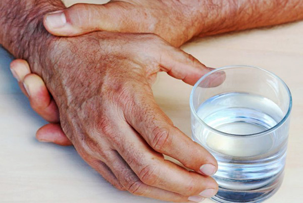 Crean la primera Red Mexicana de Asociaciones Civiles para atención del parkinson