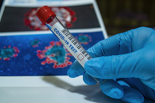 Antiviral Favipiravir es el “más prometedor” para combatir coronavirus