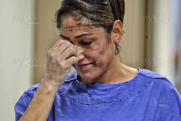 "Para que te desinfectes del COVID": una vecina ataca a doctora con cloro