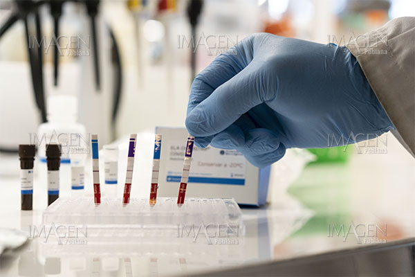 70 % de pruebas COVID-19 resulta positiva en Puebla