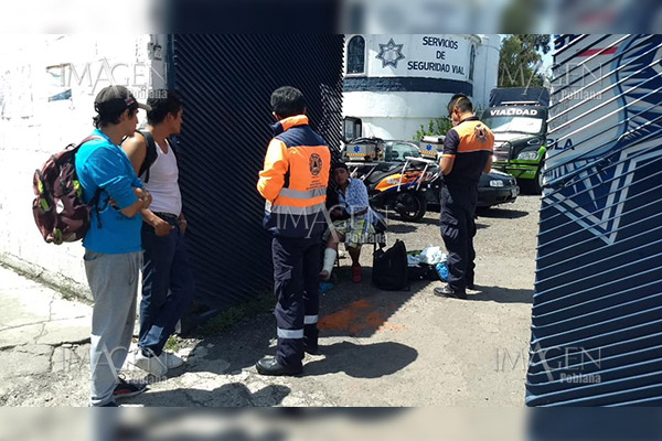 Sujetos queman con ácido a mujer en situación de calle mientras dormía