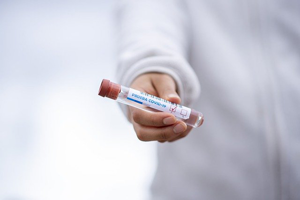 El test que permite saber si tuviste coronavirus y no te enteraste