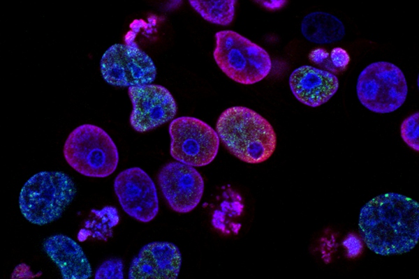 Descifran la estructura de una proteína
