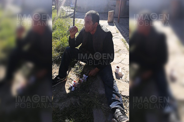 Le disparan en el rostro después de asaltarlo