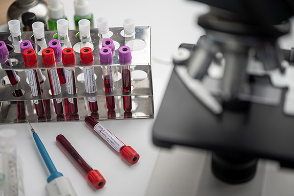 Científicos de Italia confirman que tecnología de plasma frío destruye el COVID-19