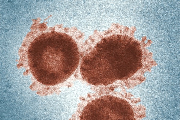 Científicos descubren un virus similar al COVID-19