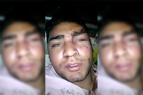 Policías de Libres abaten a un sujeto en supuesto enfrentamiento