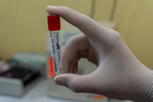 Nueva cepa del coronavirus ya se transmite de persona a persona en EU