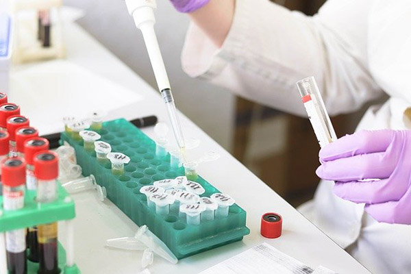 El fondo ruso RDIF lanzará unos test para identificar tipos de mutaciones del coronavirus