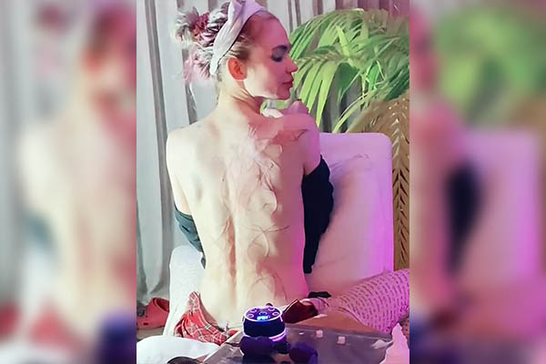 Grimes, pareja de Elon Musk, presume en redes sociales sus “hermosas cicatrices alienígenas”