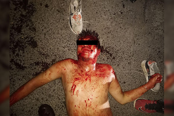 Ladrón fue apaleado tras asaltar dos negocios con pistola de juguete