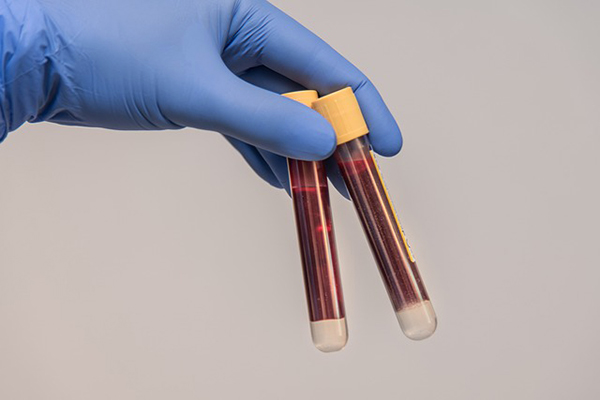 ¿Medir anticuerpos podría prever el fin de la pandemia?: el COVID-T
