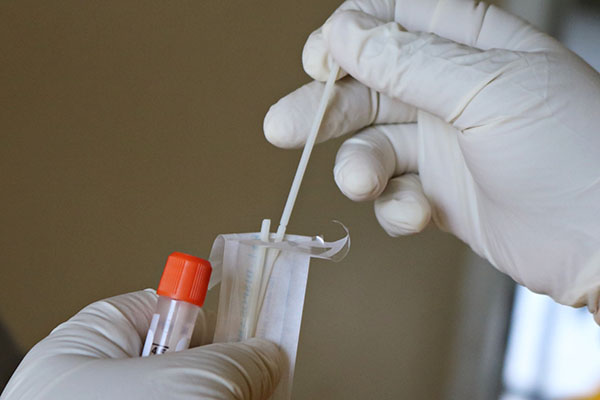Crean en Finlandia test de alta sensibilidad que detecta el contagio en 10 minutos