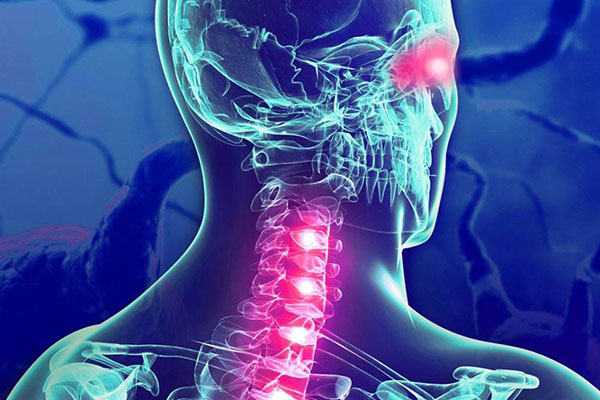 Inclusión, imprescindible en tratamiento de pacientes con Esclerosis Múltiple