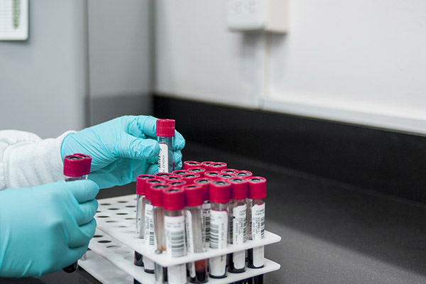 Alerta en África por virus similar al ébola; hay un caso confirmado