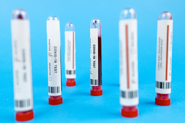 ¿Cuál es el peligro de padecer diabetes y COVID-19 al mismo tiempo?