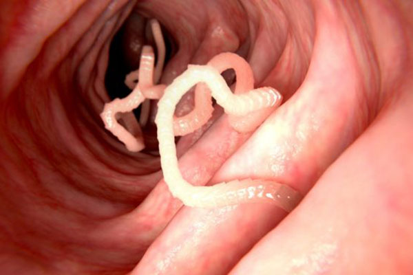 Medicamento contra la solitaria neutraliza daño que covid causa a pulmones