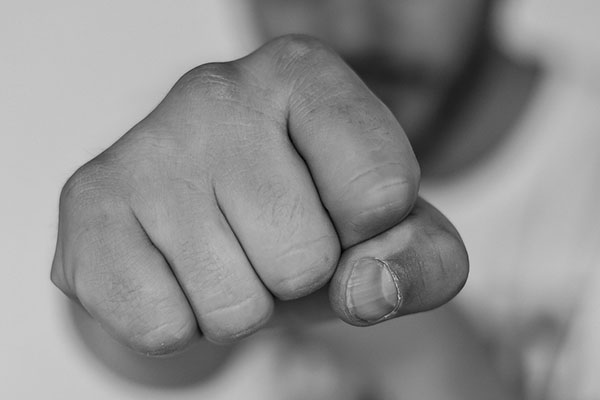 Denunciante de agresión homófoba de Madrid confiesa que lesiones fueron consentidas