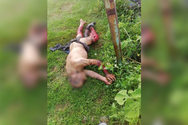Octogenario muere tras brutal ataque de perros