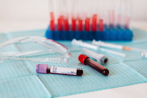 Científicos rusos desarrollan test para detectar el virus letal Nipah