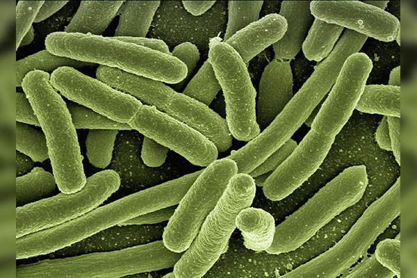 OMS llama a crear una vacuna contra bacteria que mata a 150,000 neonatos cada año