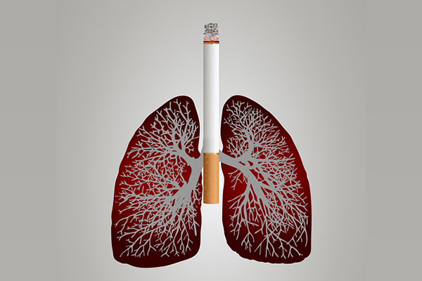 Cáncer de pulmón, más allá del tabaquismo